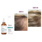 سرم مولتی پپتاید کف سر اوردینری Ordinary Scalp Multipeptide Serum - Image 2