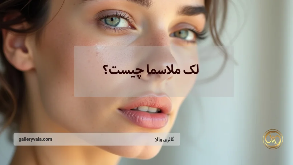لک ملاسما چیست؟ بررسی علل پیدایش و موثرترین روشهای درمان آن