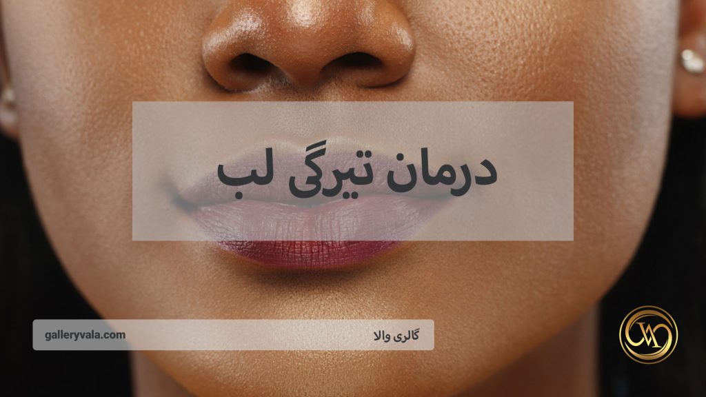 روش‌های جدید و موثر رفع سیاهی لب | گالری والا