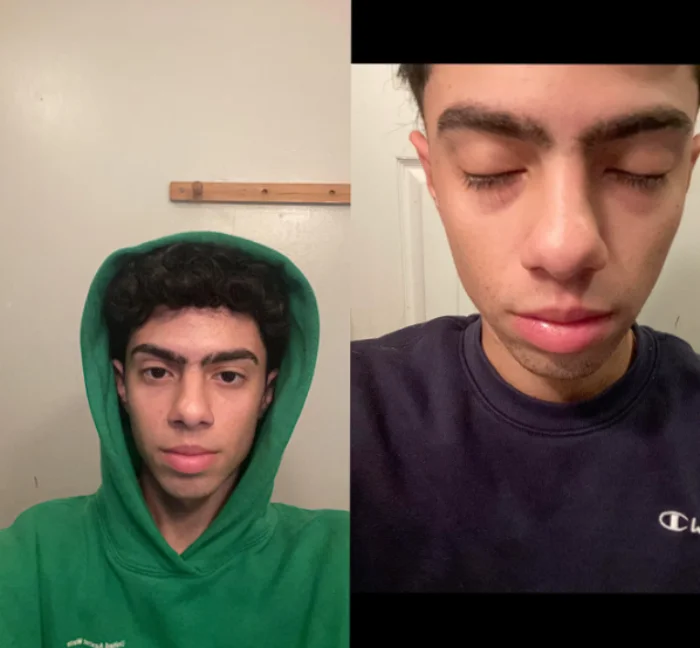 بررسی نظر کابران در مورد سرم دورچشم اوردینری