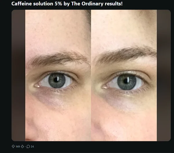 نظر کابران ردیت در مورد سرم دورچشم ضد تیرگی و پف کافئین اوردینری