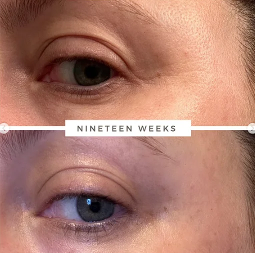 بررسی نظر کابران در مورد سرم جوانساز دور چشم اوردینری مولتی پپتید The Ordinary